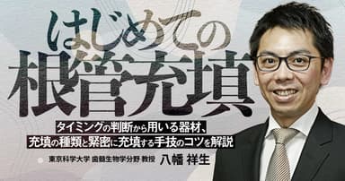 はじめての「根管充填」