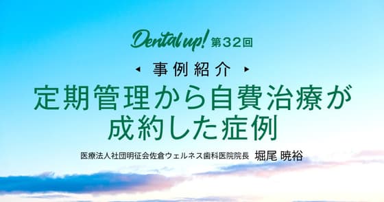 【事例紹介】定期管理から自費治療が成約した症例