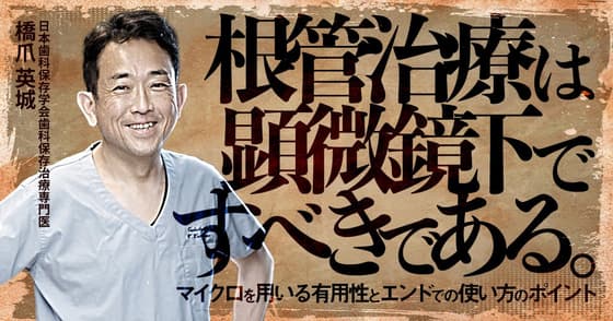 根管治療は顕微鏡下ですべきである。