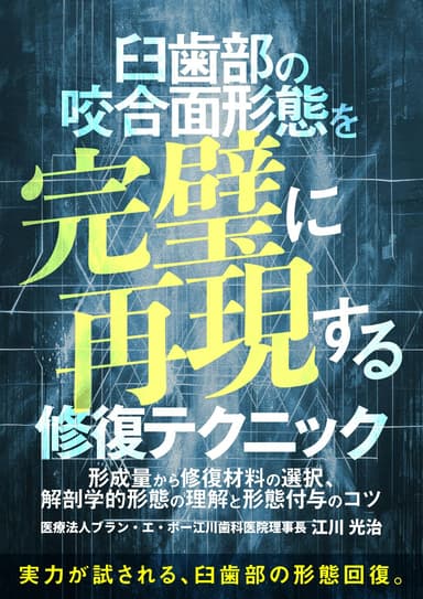 ランキング3位の臼歯部の咬合面形態を完璧に再現する修復テクニック