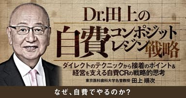 Dr.田上の自費コンポジットレジン戦略