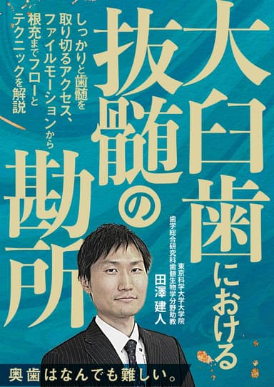 ランキング20位の大臼歯における抜髄の勘所