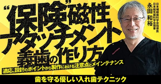 ”保険”磁性アタッチメント義歯の作り方