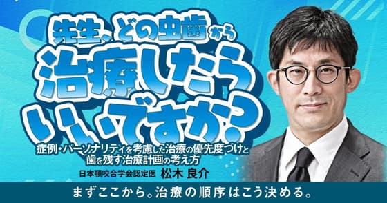 先生、どの虫歯から治療したらいいですか？
