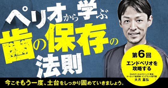 ペリオから学ぶ歯の保存の法則：第6回