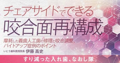 チェアサイドでできる咬合面再構成