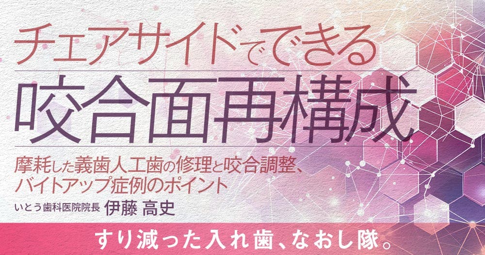 チェアサイドでできる咬合面再構成