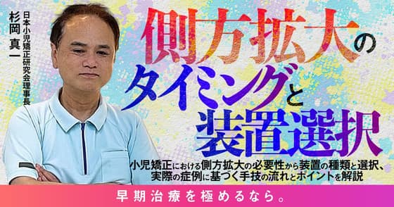 側方拡大のタイミングと装置選択