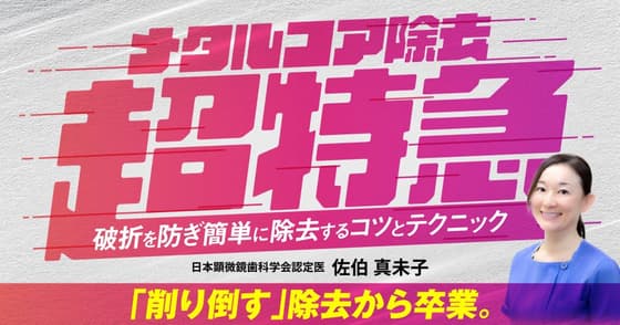 メタルコア除去超特急