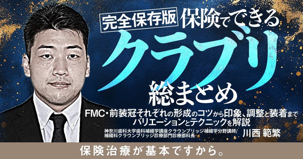 【完全保存版】保険でできるクラブリ総まとめ - FMC・前装冠それぞれの形成のコツから印象、調整と装着までバリエーションとテクニックを解説