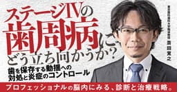 ステージⅣの歯周病にどう立ち向かうか？