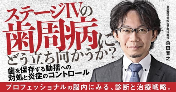 ステージⅣの歯周病にどう立ち向かうか？