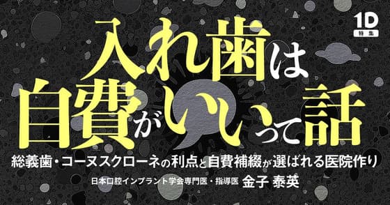 入れ歯は自費がいいって話