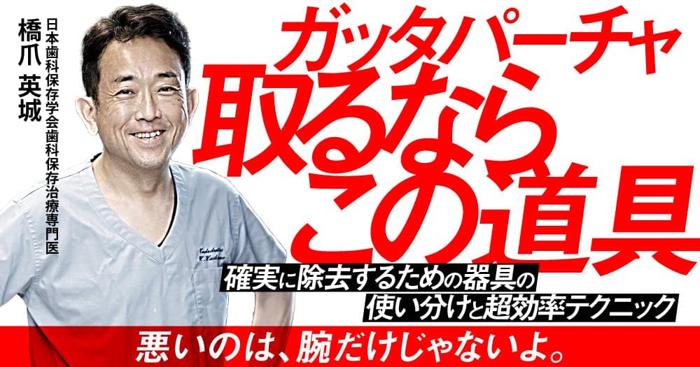 ガッタパーチャ取るならこの道具