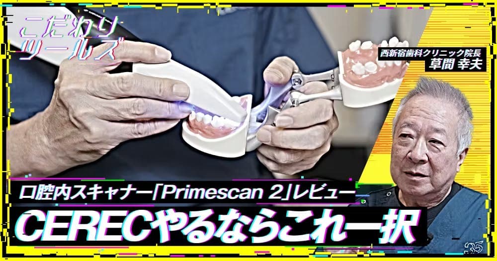 CERECやるならこれ一択。口腔内スキャナー「Primescan 2」レビュー - 【こだわりツールズ】Primescan 2の価格・性能・臨床応用の実際