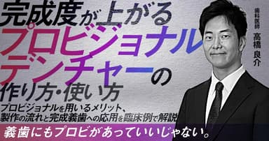 完成度が上がる「プロビジョナルデンチャー」の作り方・使い方