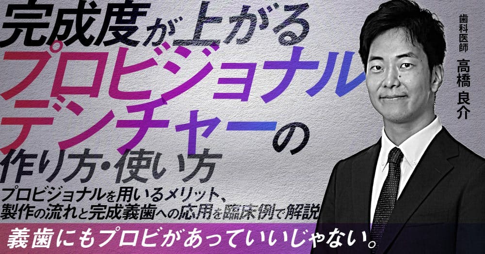 完成度が上がる「プロビジョナルデンチャー」の作り方・使い方 - プロビジョナルを用いるメリット、製作の流れと完成義歯への応用を臨床例で解説
