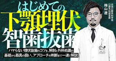 はじめての「下顎埋伏智歯抜歯」