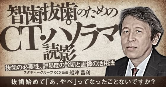 智歯抜歯のためのCT・パノラマ読影