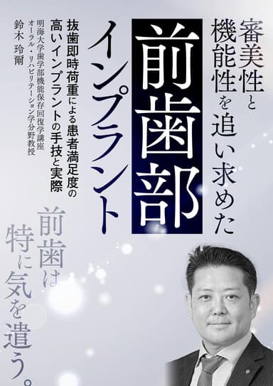 ランキング8位の審美性と機能性を追い求めた前歯部インプラント