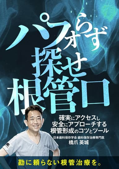 ランキング1位のパフォらず探せ根管口