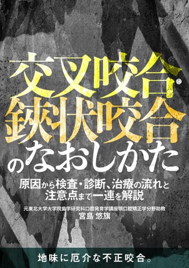 ランキング4位の交叉咬合・鋏状咬合のなおしかた