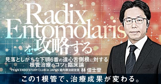 Radix Entomolarisを攻略する