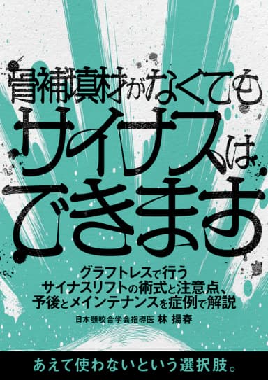 ランキング10位の骨補填材がなくてもサイナスはできます