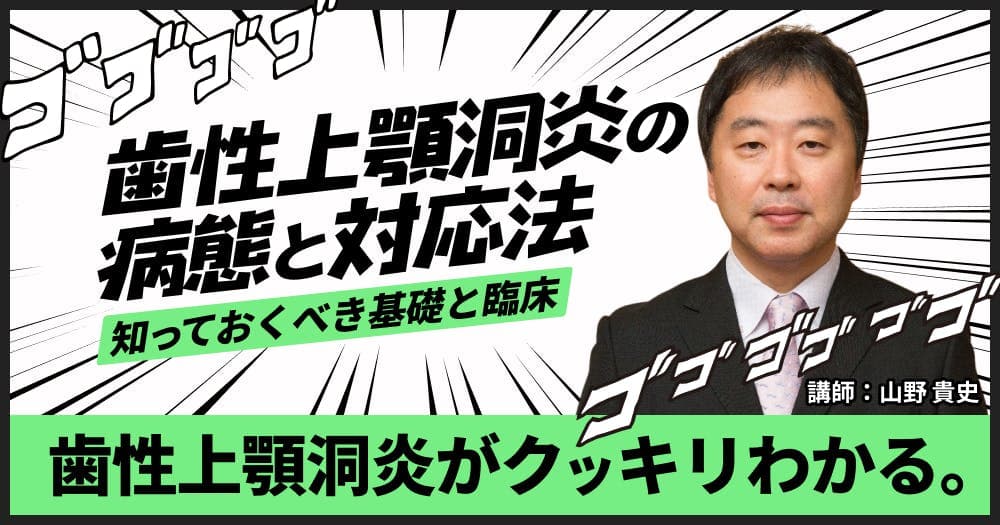 歯性上顎洞炎の病態と対応法