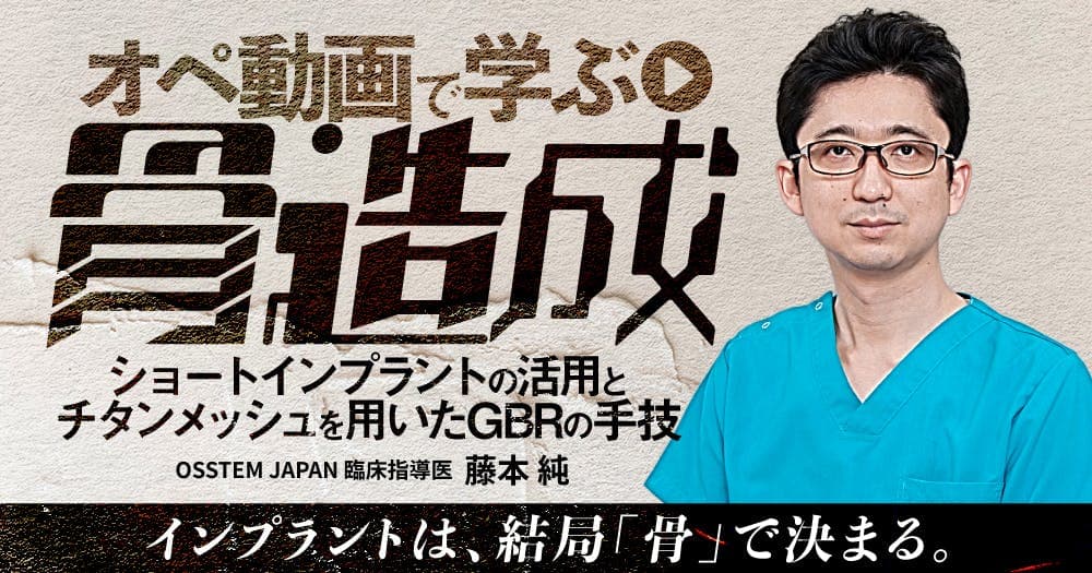 オペ動画で学ぶ「骨造成」 - ショートインプラントの活用とチタンメッシュを用いたGBRの手技