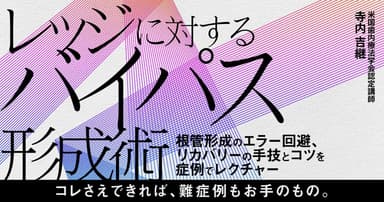 レッジに対するバイパス形成術
