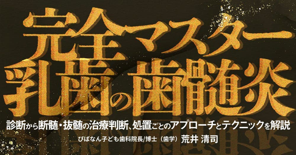 完全マスター「乳歯の歯髄炎」 - 診断から断髄・抜髄の治療判断、処置ごとのアプローチとテクニックを解説