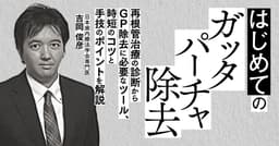 はじめての「ガッタパーチャ除去」