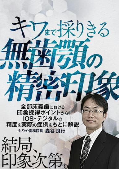 ランキング9位のキワまで採りきる無歯顎の精密印象