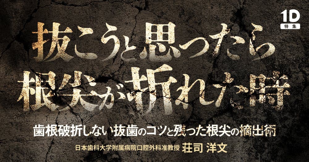 抜こうと思ったら根尖が折れた時