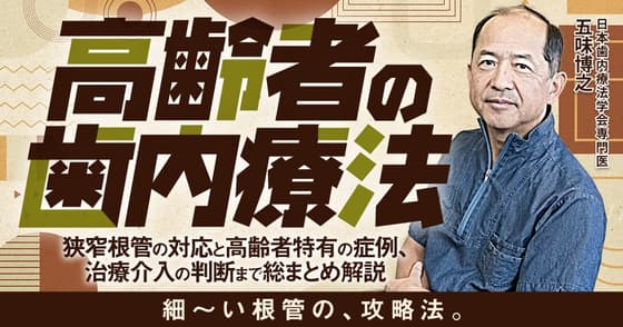 高齢者の歯内療法