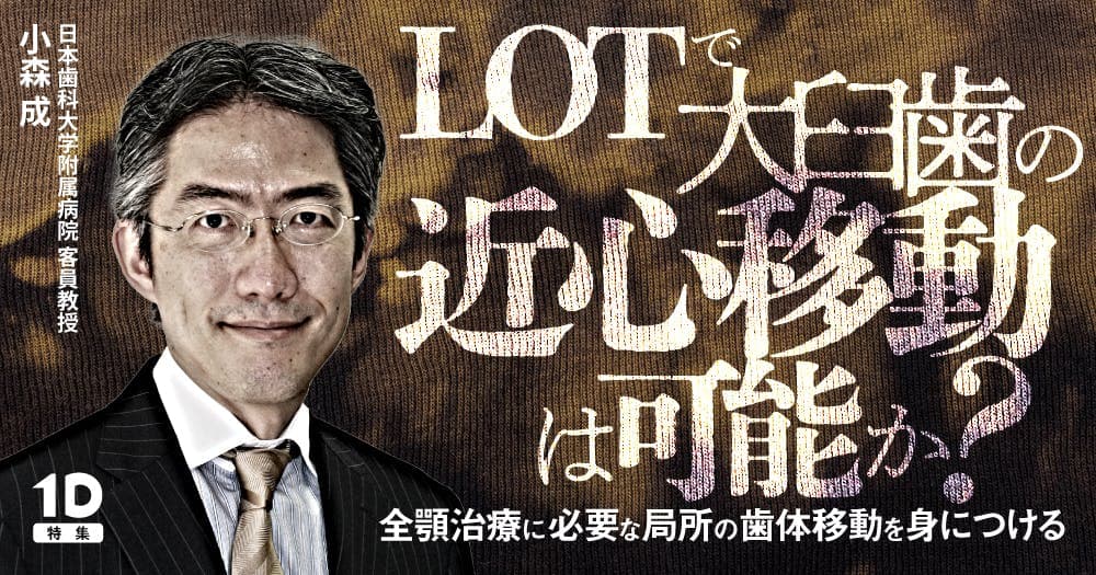 LOTで大臼歯の近心移動は可能か？