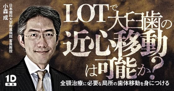 LOTで大臼歯の近心移動は可能か？