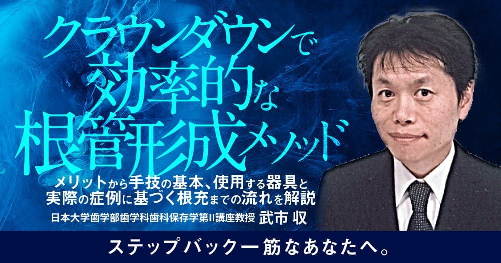 クラウンダウンで効率的な根管形成メソッド - メリットから手技の基本、使用する器具と実際の症例に基づく根充までの流れを解説