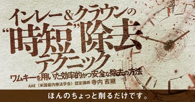 インレー&クラウンの”時短”除去テクニック