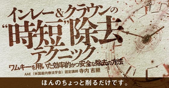 インレー&クラウンの”時短”除去テクニック