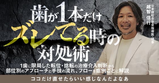 歯が1本だけズレてる時の対処術