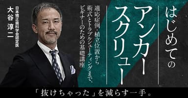 はじめての「アンカースクリュー」