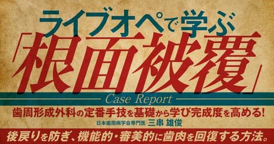 ライブオペで学ぶ「根面被覆」＜Case Report＞