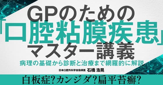 GPのための「口腔粘膜疾患」マスター講義。それ実はカンジダや白板症、口腔扁平苔癬かも？