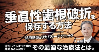 垂直性歯根破折を保存する方法