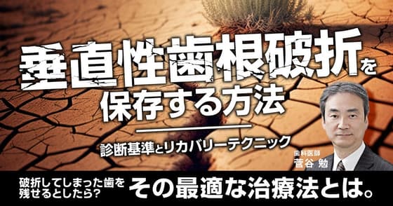 垂直性歯根破折を保存する方法