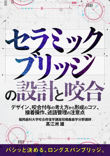 ランキング13位のセラミックブリッジの設計と咬合