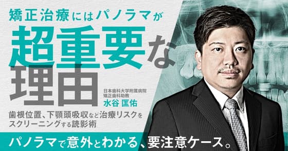 矯正治療にはパノラマが超重要な理由