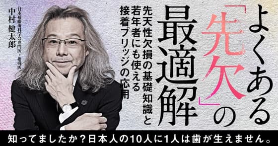 よくある「先欠」の最適解